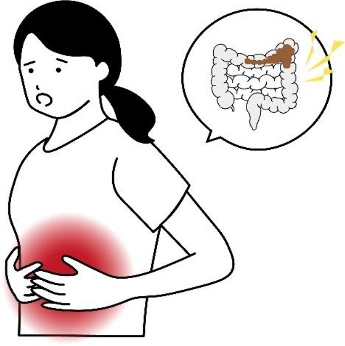 潰瘍性大腸炎の原因 ttl=